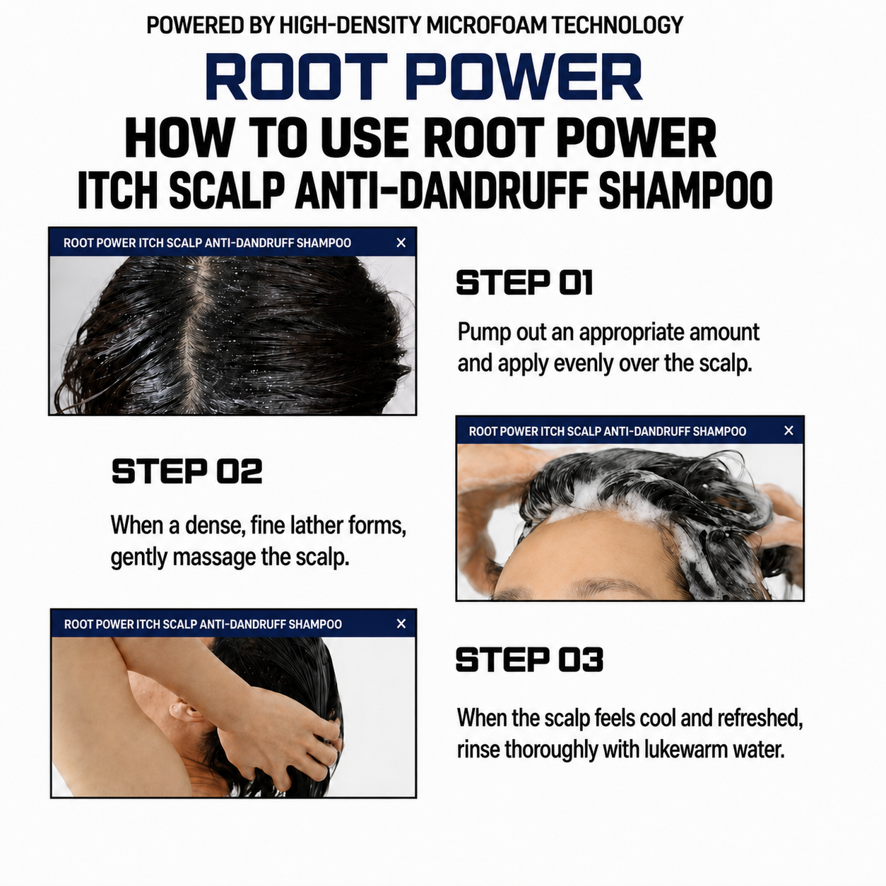 BLACK FORER ROOTPOWER ITCH SCALP ANTI-DANDRUFF SHAMPOO